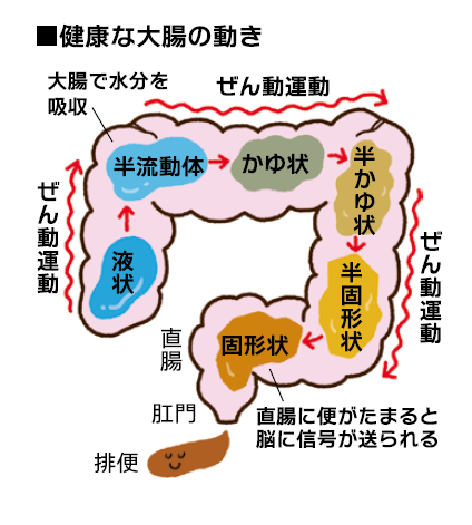 油断しないで 自己流の対処は危険 便秘