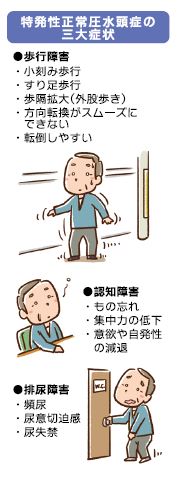 手術でよくなる認知症 特発性正常圧水頭症 手術でよくなる認知症 特発性正常圧水頭症