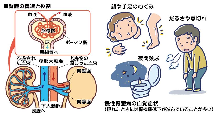 とにかく安静 から 運動して改善 へ 慢性腎臓病 とにかく安静 から 運動して改善 へ 慢性腎臓病