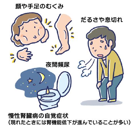 とにかく安静 から 運動して改善 へ 慢性腎臓病 とにかく安静 から 運動して改善 へ 慢性腎臓病