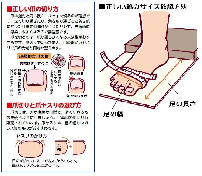 症状が出やすい夏こそ放置は禁物 爪水虫